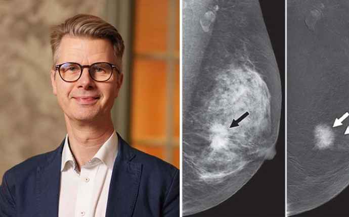 Magnus Bäcklund, onkolog om den forskning han arbetar med idag