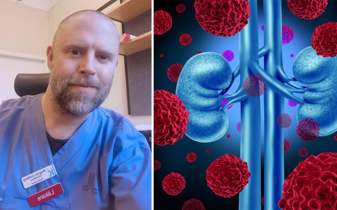 Fem patientfall om njurcancer – ny fortbildning för onkologer och urologer