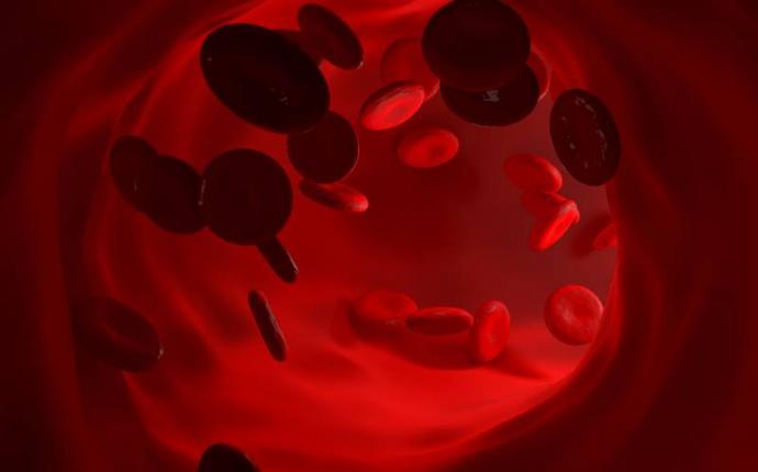 EHA 2022: Höjdpunkterna från hematologimötet du inte vill missa 