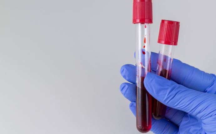 ASH 2020: T-cellerna blir allt viktigare i behandling av hematologiska maligniteter