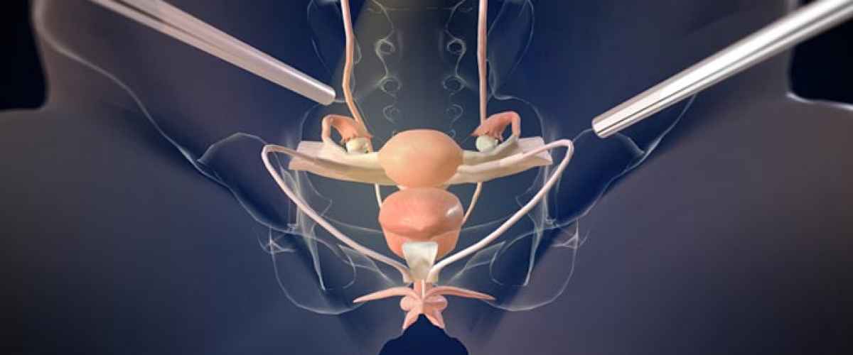 ESMO 2023: Nya studier om livmoderhalscancer kan påverka rekommendationerna