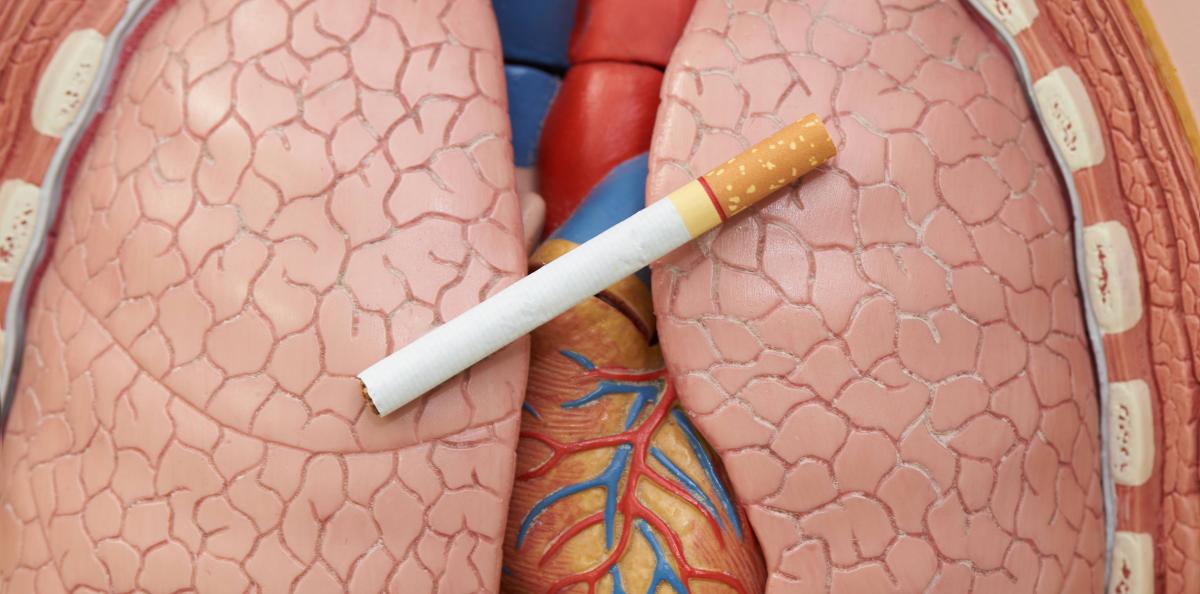 11 cirkulerade myter om lungcancer