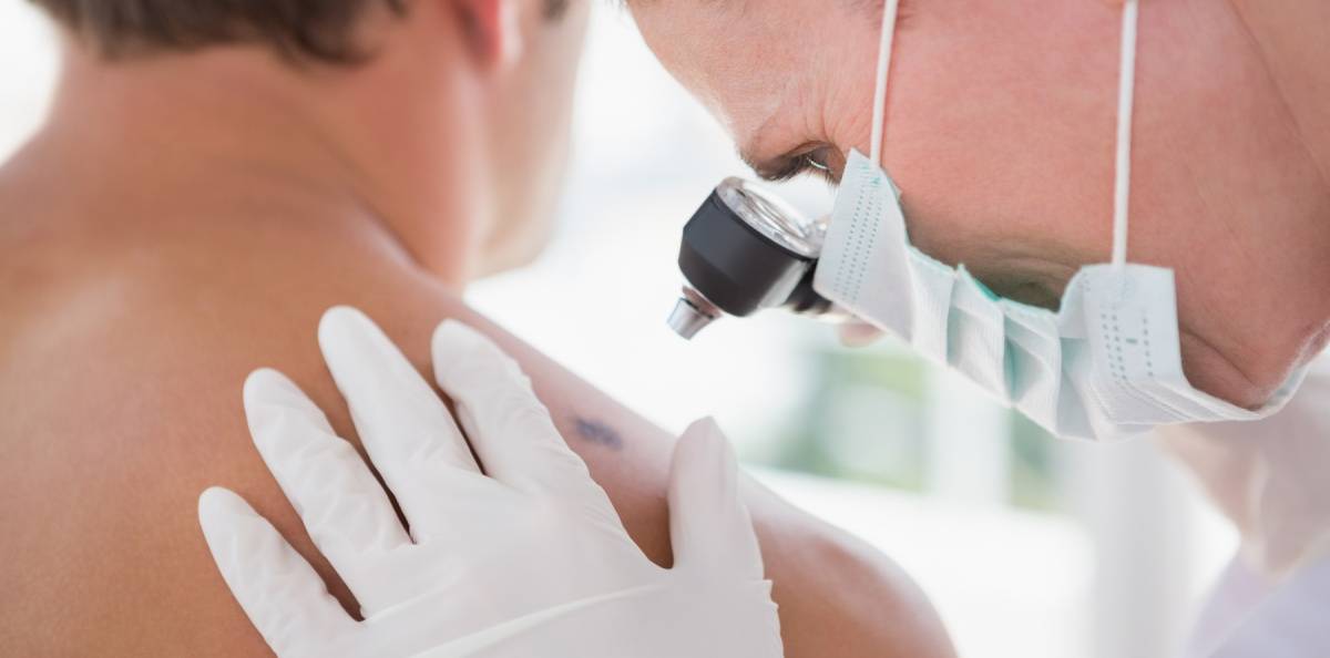 Ny läkemedelsrekommendation för patienter med malignt melanom
