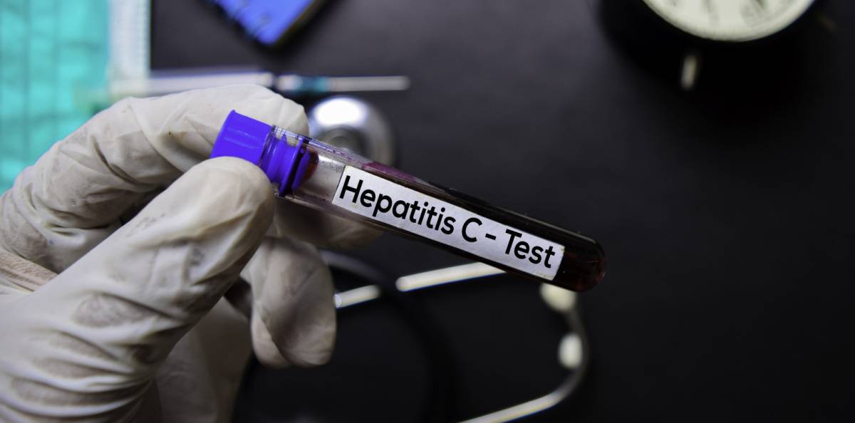 Så kan läkare bidra till att minska spridningen av hepatit C