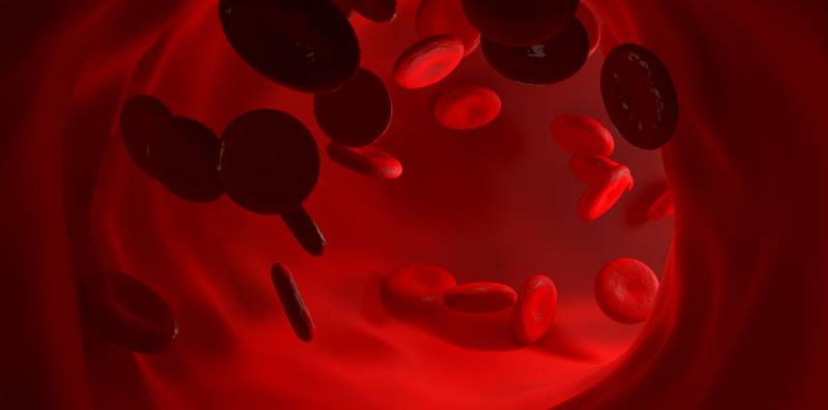 EHA 2022: Höjdpunkterna från hematologimötet du inte vill missa 