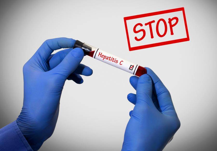 Dags att eliminera Hepatit C i Sverige2