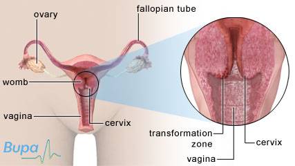 Globalt inträffar årligen cirka 470 000 nya fall av cervixcancer (livmoderhalscancer), vilket utgör ungefär 10 procent av all cancer hos kvinnor. Mer än hälften av de drabbade dör i sin sjukdom.