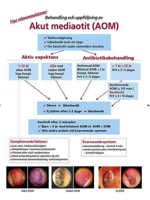 Öroninflammation (akut mediaotit AOM) rekommendation om behandling, uppföljning